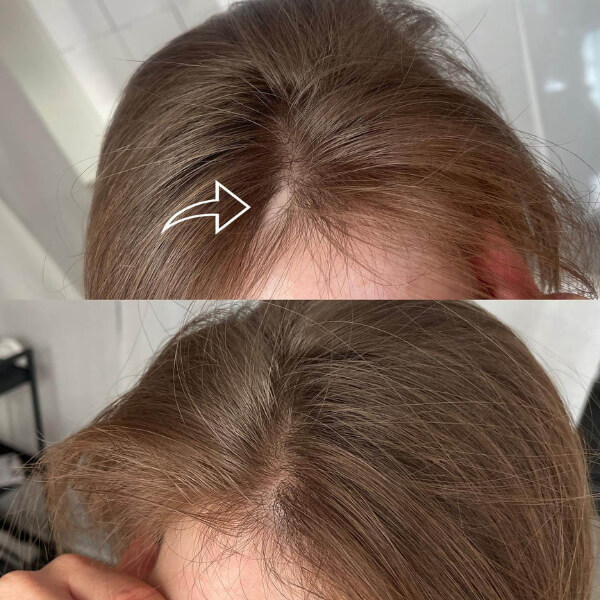 micropigmentation-cheveux-femme